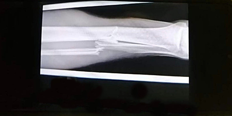 A kiérkező mentősök diagnózisa helyesnek bizonyult - Fotó: futsalveszprem.hu