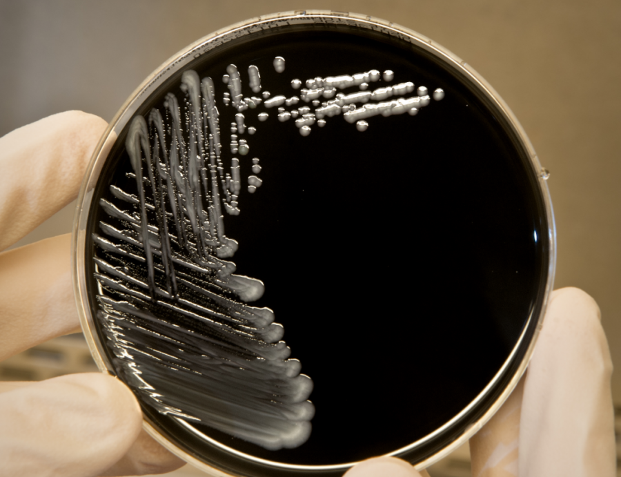 A legionella baktérium a langyos vízben szaporodik el